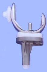Knieprothese (zijaanzicht)