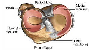 Kijkoperatie, knieoperatie, knie, versleten knie